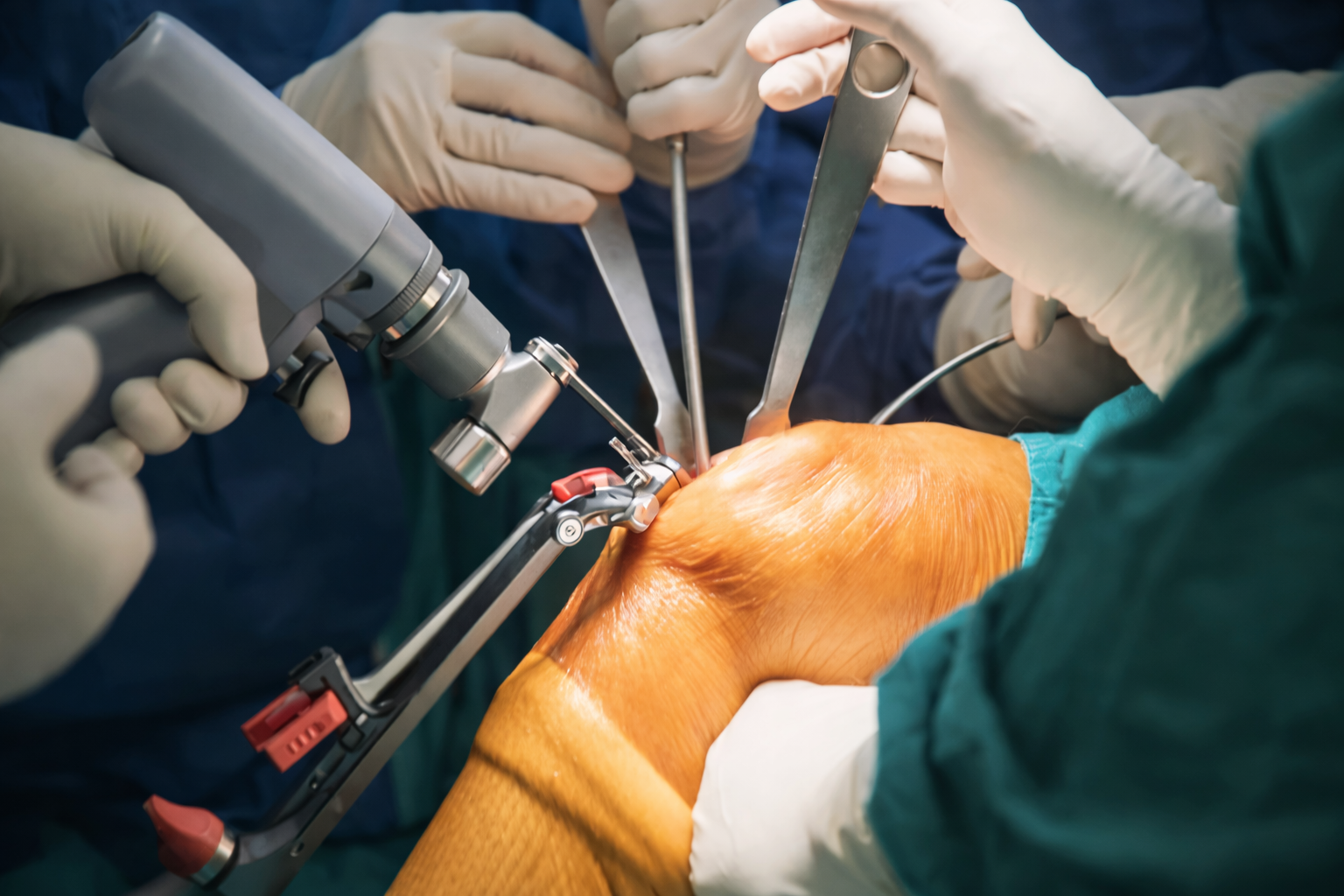 Orthopaedics